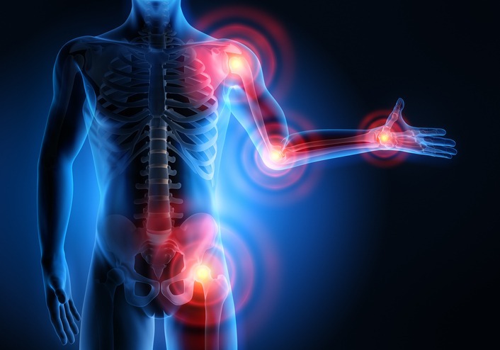 príčiny bolesti kĺbov